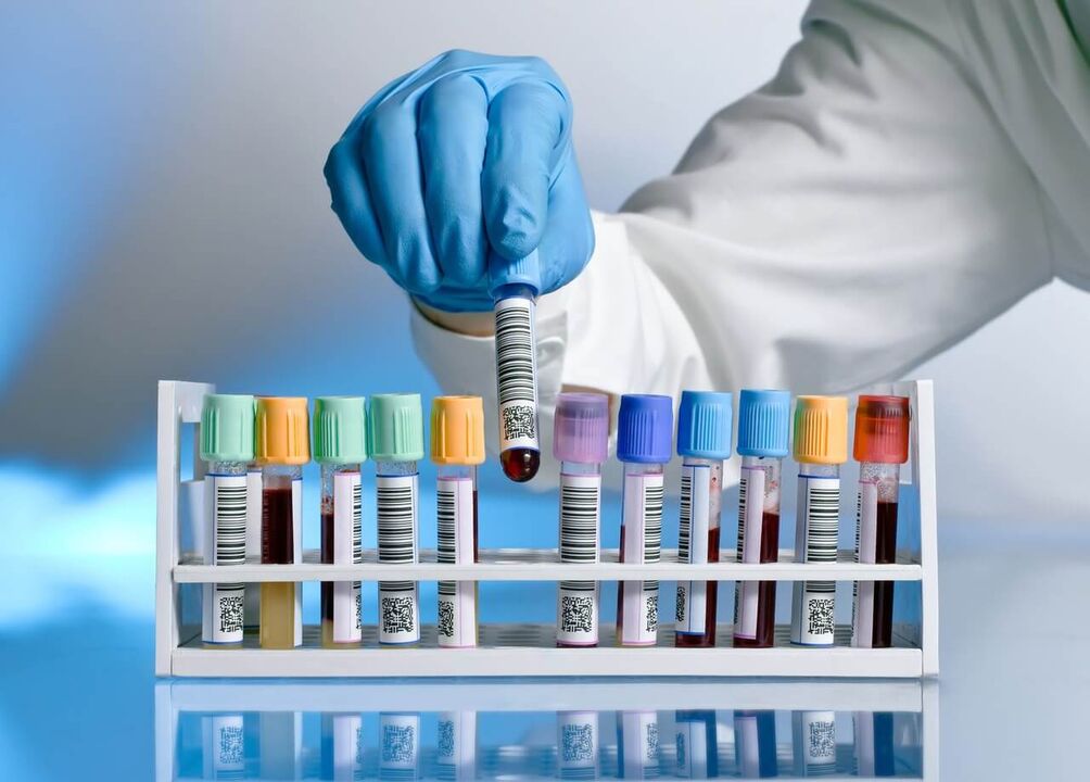 blood test for pathological secretions during excitement