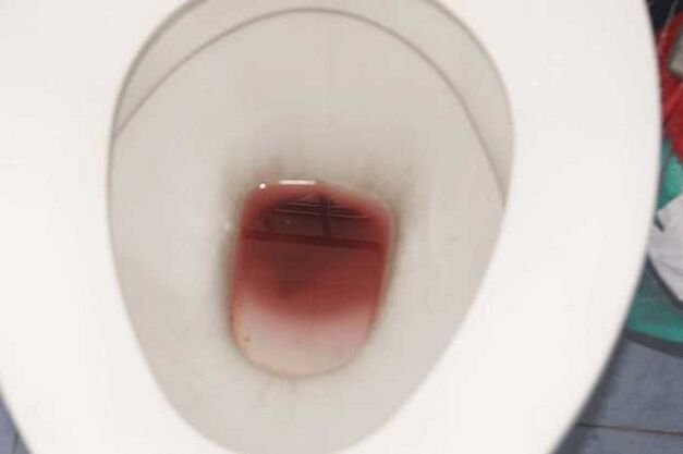 noticing when men are excited